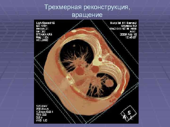 Трехмерная реконструкция, вращение 