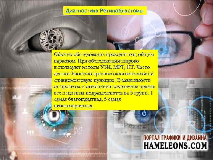 Диагностика Ретинобластомы Обычно обследование проходит под общим наркозом. При обследовании широко используют методы УЗИ,