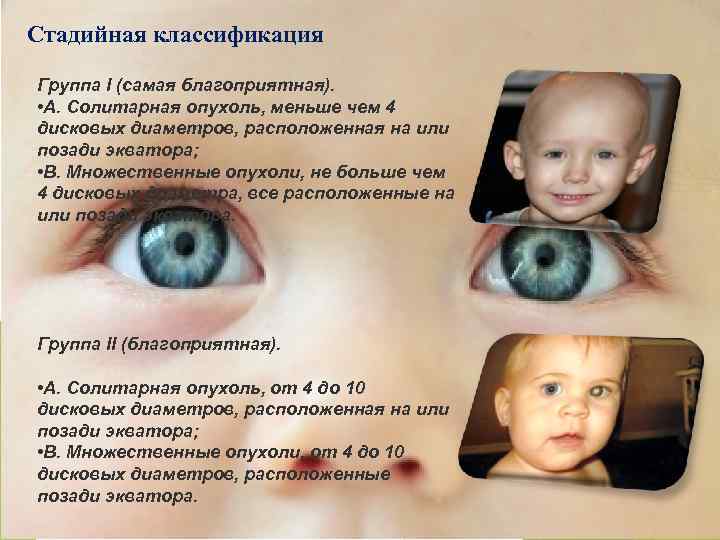 Стадийная классификация Группа I (самая благоприятная). • А. Солитарная опухоль, меньше чем 4 дисковых