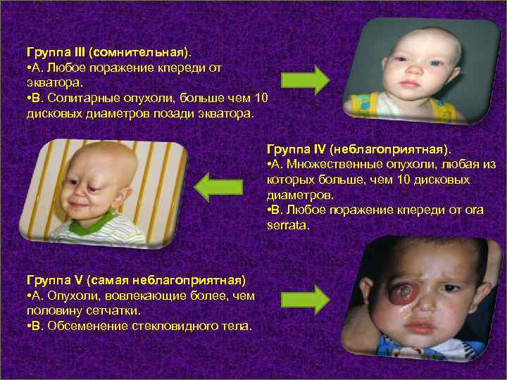 Группа III (сомнительная). • А. Любое поражение кпереди от экватора. • В. Солитарные опухоли,