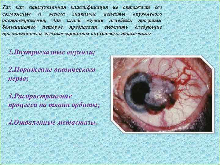 Так как вышеуказанная классификация не отражает все возможные и весьма значимые аспекты опухолевого распространения,