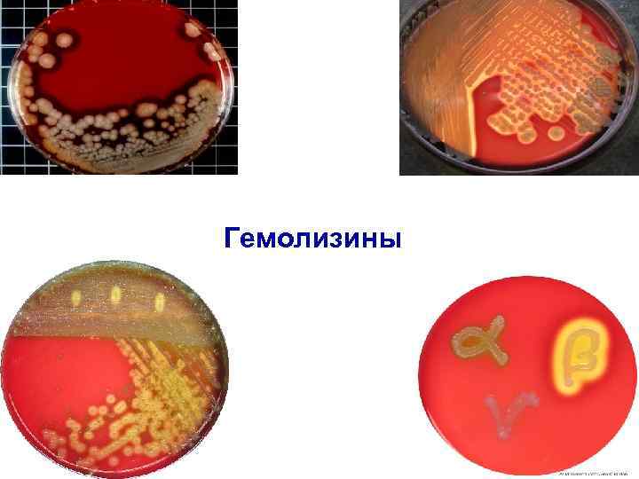 Гемолизины 