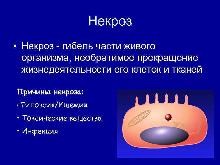 Некроз • Некроз - гибель части живого организма, необратимое прекращение жизнедеятельности его клеток и