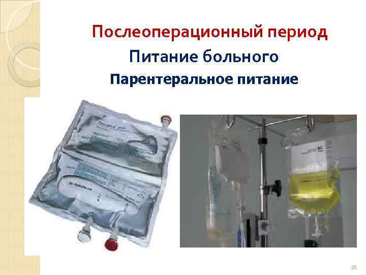 Послеоперационный период Питание больного Парентеральное питание 35 
