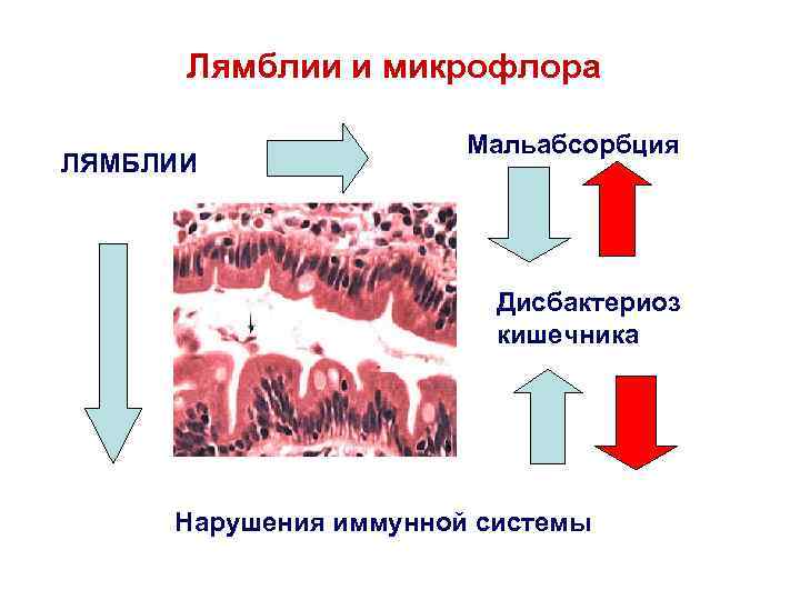 Лямблии и микрофлора ЛЯМБЛИИ Мальабсорбция Дисбактериоз кишечника Нарушения иммунной системы 