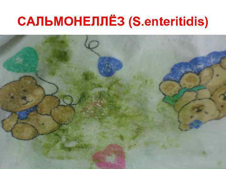 САЛЬМОНЕЛЛЁЗ (S. enteritidis) 