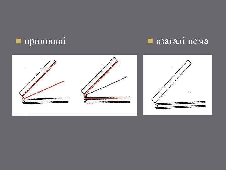 n пришивні n взагалі нема 