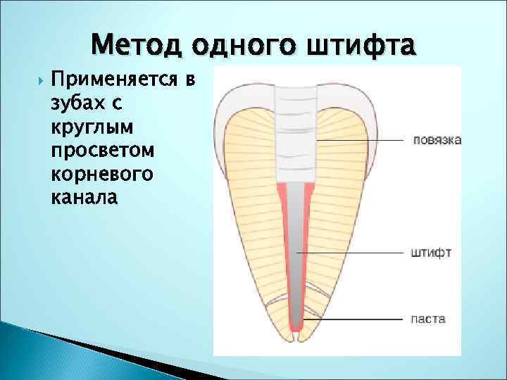 Метод одного штифта Применяется в зубах с круглым просветом корневого канала 
