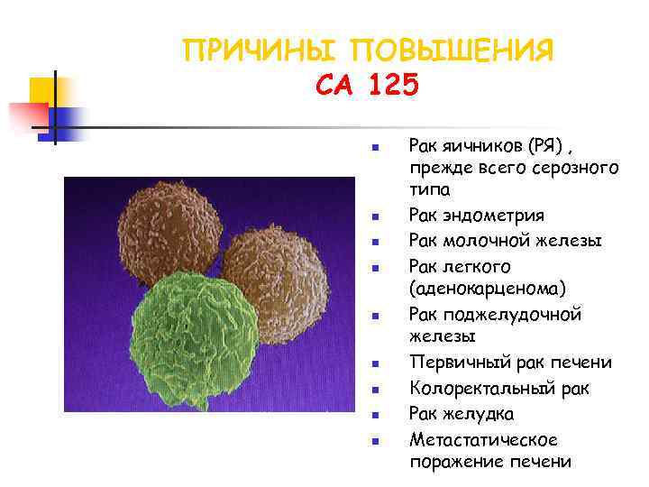 ПРИЧИНЫ ПОВЫШЕНИЯ СА 125 n n n n n Рак яичников (РЯ) , прежде