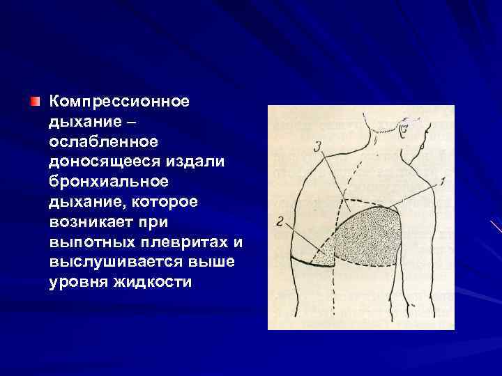 Компрессионное дыхание – ослабленное доносящееся издали бронхиальное дыхание, которое возникает при выпотных плевритах и