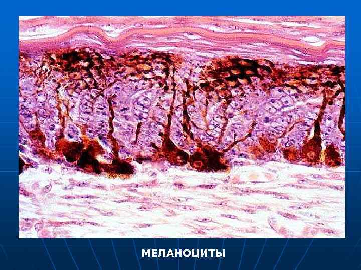 МЕЛАНОЦИТЫ 