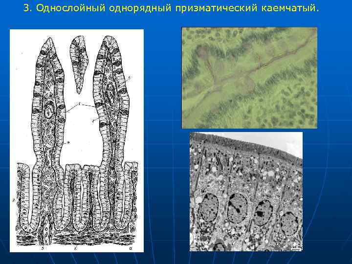 3. Однослойный однорядный призматический каемчатый. 