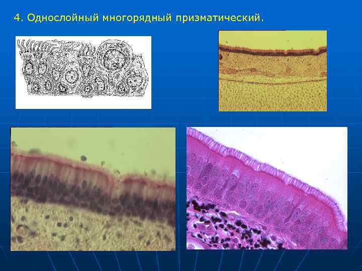 4. Однослойный многорядный призматический. 
