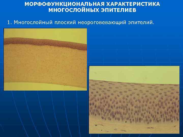 МОРФОФУНКЦИОНАЛЬНАЯ ХАРАКТЕРИСТИКА МНОГОСЛОЙНЫХ ЭПИТЕЛИЕВ 1. Многослойный плоский неороговевающий эпителий. 