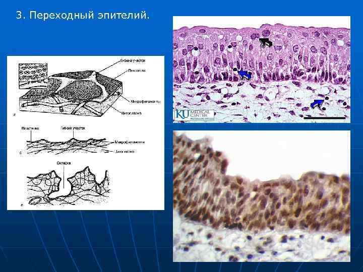 3. Переходный эпителий. 