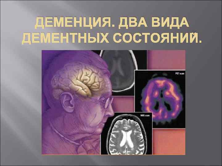 ДЕМЕНЦИЯ. ДВА ВИДА ДЕМЕНТНЫХ СОСТОЯНИЙ. 