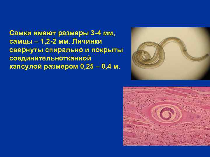 Самки имеют размеры 3 -4 мм, самцы – 1, 2 -2 мм. Личинки свернуты