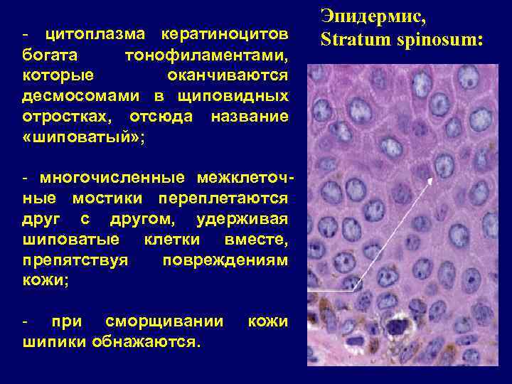 - цитоплазма кератиноцитов богата тонофиламентами, которые оканчиваются десмосомами в щиповидных отростках, отсюда название «шиповатый»