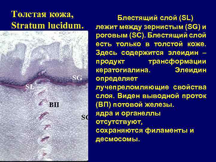 Толстая кожа, Stratum lucidum. SL ВП Блестящий слой (SL) лежит между зернистым (SG) и