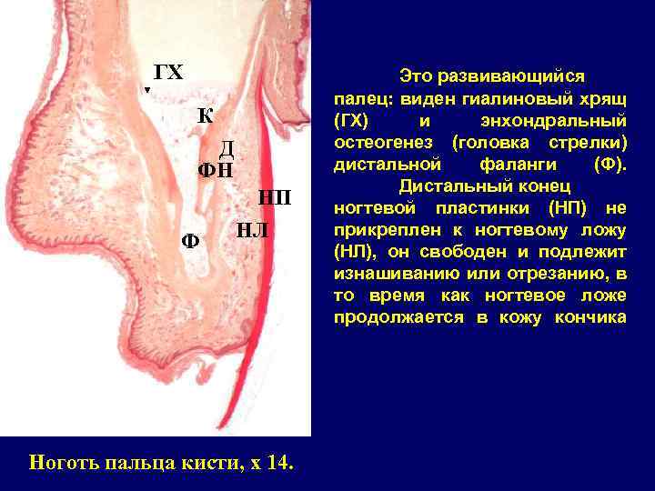 ГХ К Д ФН Ф НП НЛ Ноготь пальца кисти, x 14. Это развивающийся
