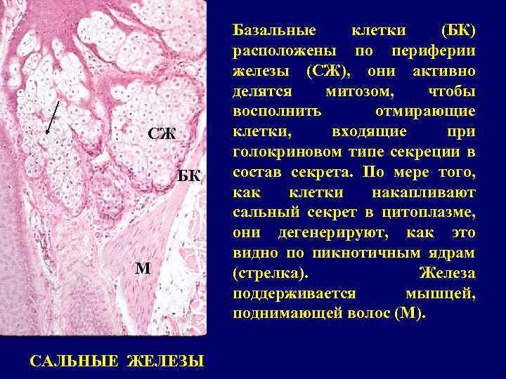 СЖ БК М САЛЬНЫЕ ЖЕЛЕЗЫ Базальные клетки (БК) расположены по периферии железы (СЖ), они