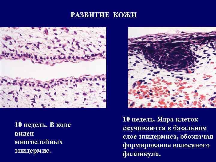 РАЗВИТИЕ КОЖИ 10 недель. В коде виден многослойных эпидермис. 10 недель. Ядра клеток скучиваются