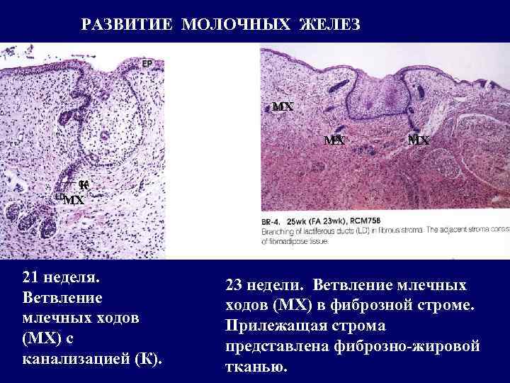 РАЗВИТИЕ МОЛОЧНЫХ ЖЕЛЕЗ МХ МХ МХ К МХ 21 неделя. Ветвление млечных ходов (МХ)
