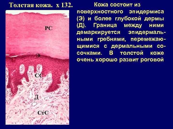 Толстая кожа. x 132. РС Э СС Д Ст. С Кожа состоит из поверхностного