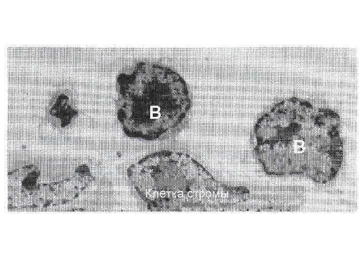 B B Клетка стромы 