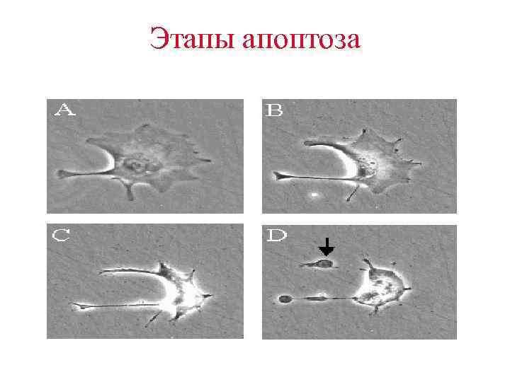 Этапы апоптоза 
