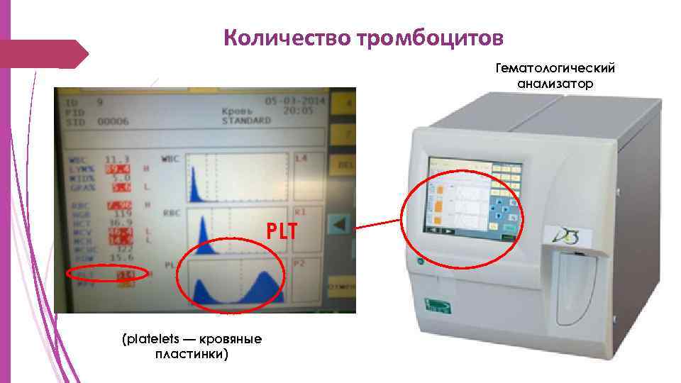 Количество тромбоцитов Гематологический анализатор PLT (platelets — кровяные пластинки) 