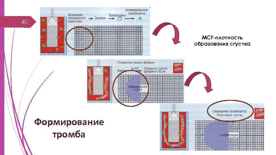 40 MCF-плотность образования сгустка Формирование тромба 