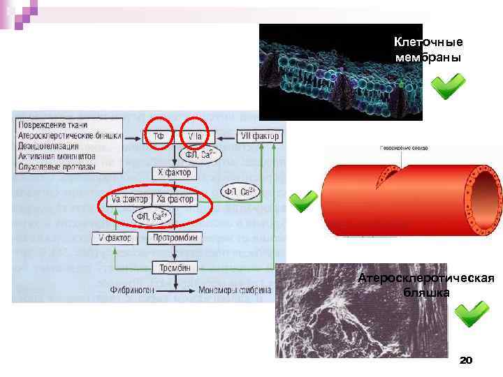 Клеточные мембраны Атеросклеротическая бляшка 20 