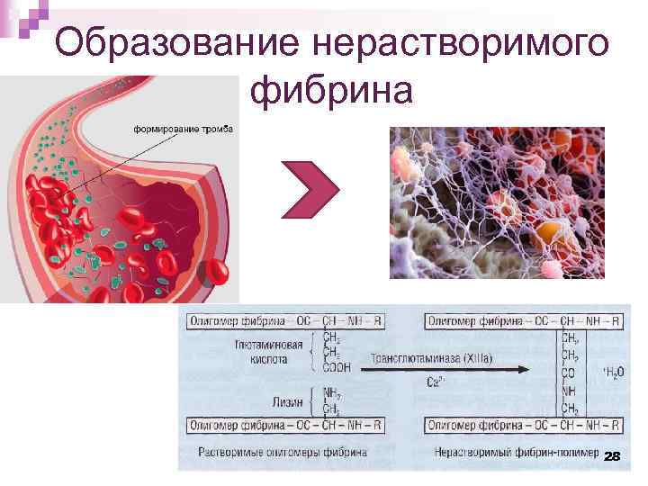 Образование нерастворимого фибрина 28 