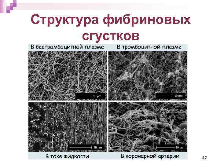 Структура фибриновых сгустков 37 