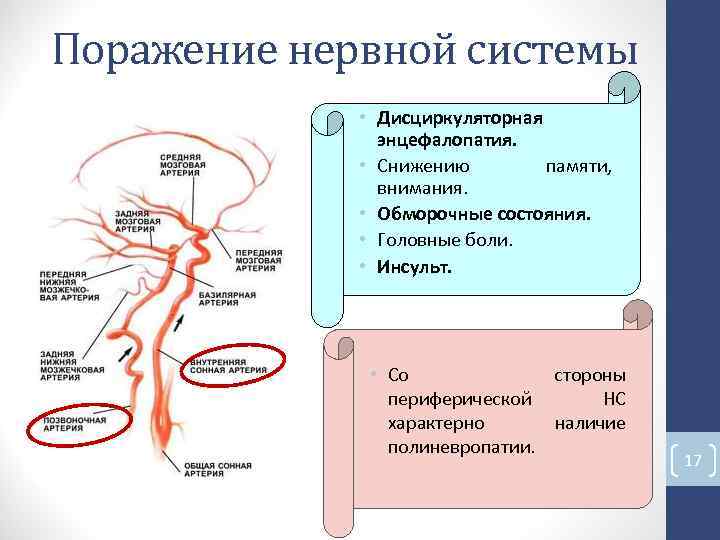 Поражение нервной системы • Дисциркуляторная энцефалопатия. • Снижению памяти, внимания. • Обморочные состояния. • Поражение нервной системы • Дисциркуляторная энцефалопатия. • Снижению памяти, внимания. • Обморочные состояния. •