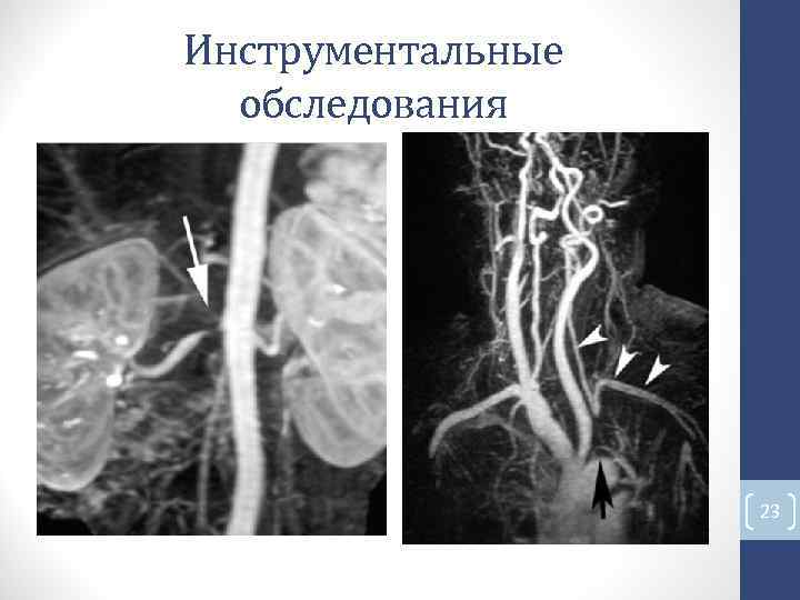 Инструментальные обследования 23 Инструментальные обследования 23
