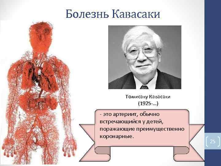 Болезнь Кавасаки Томисаку Кавасаки (1925 -…) - это артериит, обычно встречающийся у детей, поражающие Болезнь Кавасаки Томисаку Кавасаки (1925 -…) - это артериит, обычно встречающийся у детей, поражающие