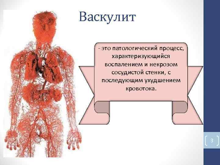 Васкулит - это патологический процесс, характеризующийся воспалением и некрозом сосудистой стенки, с последующим ухудшением Васкулит - это патологический процесс, характеризующийся воспалением и некрозом сосудистой стенки, с последующим ухудшением