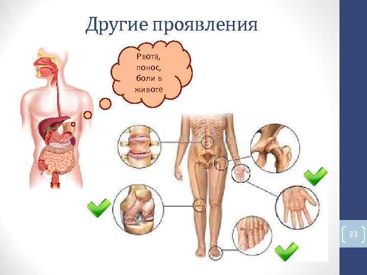 Другие проявления Рвота, понос, боли в животе 33 Другие проявления Рвота, понос, боли в животе 33