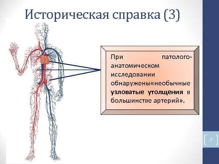 Историческая справка (3) При патолого- анатомическом исследовании обнаружены «необычные узловатые утолщения в большинстве артерий» Историческая справка (3) При патолого- анатомическом исследовании обнаружены «необычные узловатые утолщения в большинстве артерий»