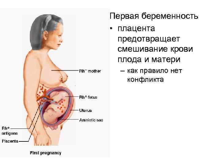 Первая беременность • плацента предотвращает смешивание крови плода и матери – как правило нет