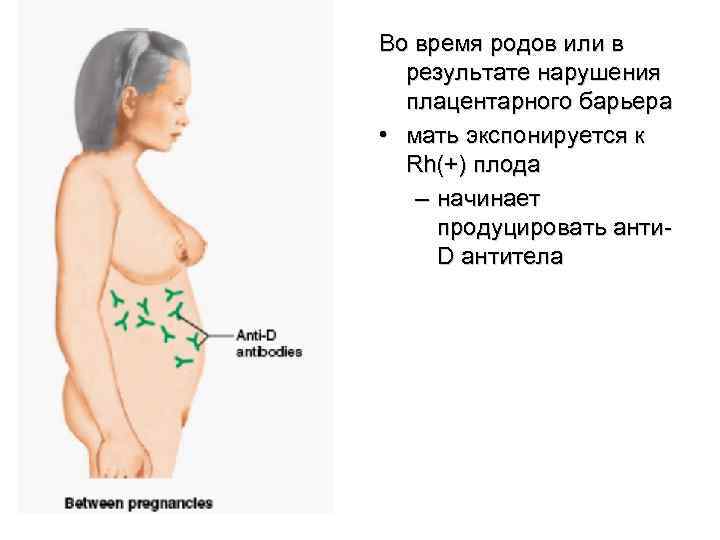 Во время родов или в результате нарушения плацентарного барьера • мать экспонируется к Rh(+)