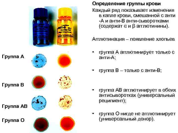 Определение группы крови Каждый ряд показывает изменения в капле крови, смешанной с анти -A