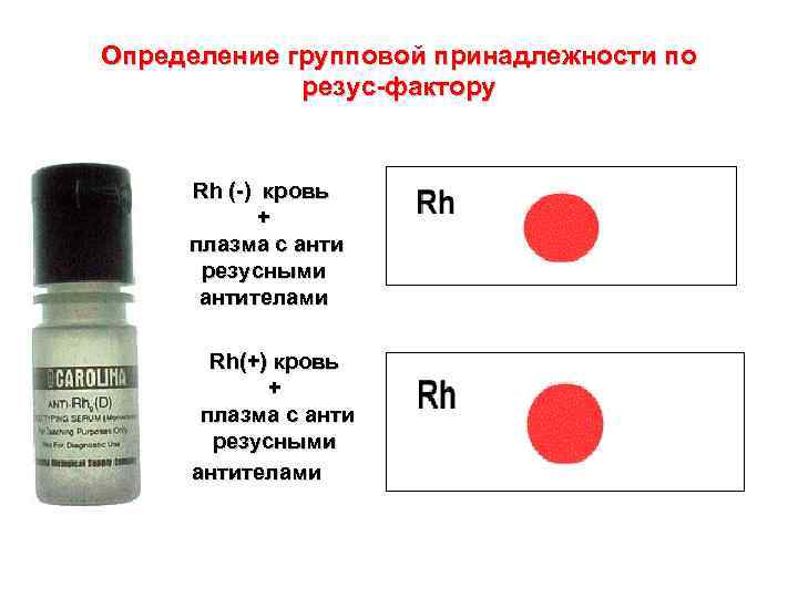 Определение групповой принадлежности по резус-фактору Rh (-) кровь + плазма с анти резусными антителами
