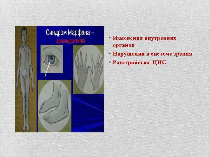  • Изменения внутренних органов • Нарушения в системе зрения • Расстройства ЦНС 