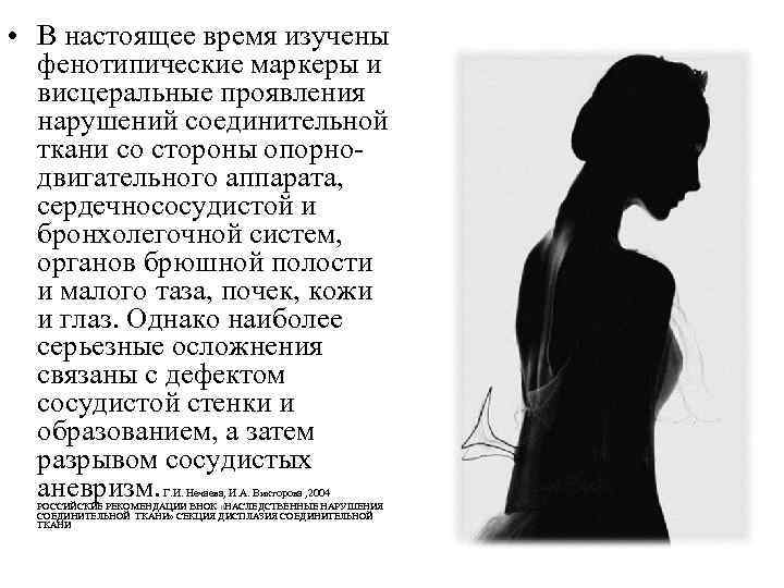  • В настоящее время изучены фенотипические маркеры и висцеральные проявления нарушений соединительной ткани