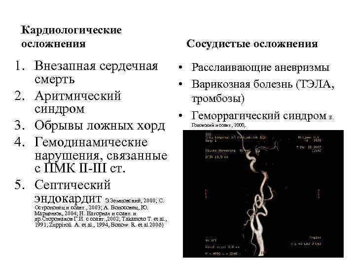 Кардиологические осложнения Сосудистые осложнения 1. Внезапная сердечная • Расслаивающие аневризмы смерть • Варикозная болезнь
