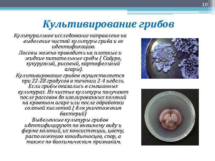 10 Культивирование грибов Культуральное исследование направлено на выделение чистой культуры гриба и ее идентификацию.