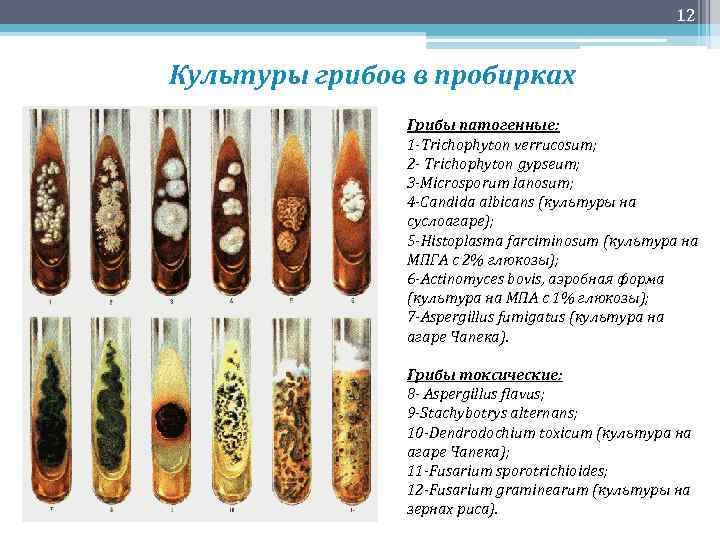 12 Культуры грибов в пробирках Грибы патогенные: 1 -Trichophyton verrucosum; 2 - Trichophyton gypseum;